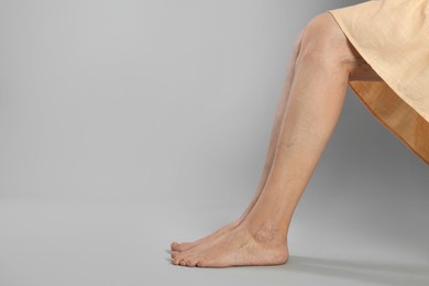 Photo of Closeup view of woman with varicose veins on light grey background. Space for text