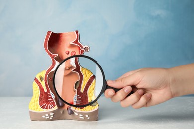 Photo of Doctor with magnifying glass showing model of unhealthy lower rectum on light blue background, closeup. Hemorrhoid problem
