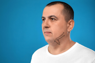 Mature man with marks on face against blue background. Double chin removal