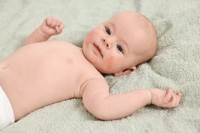 Cute little baby with allergic redness on cheeks lying on light green blanket