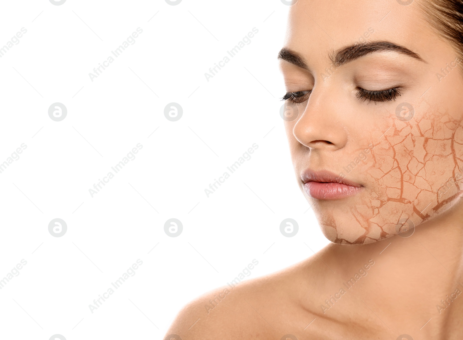 Image of Beautiful young woman with dry skin on white background, closeup