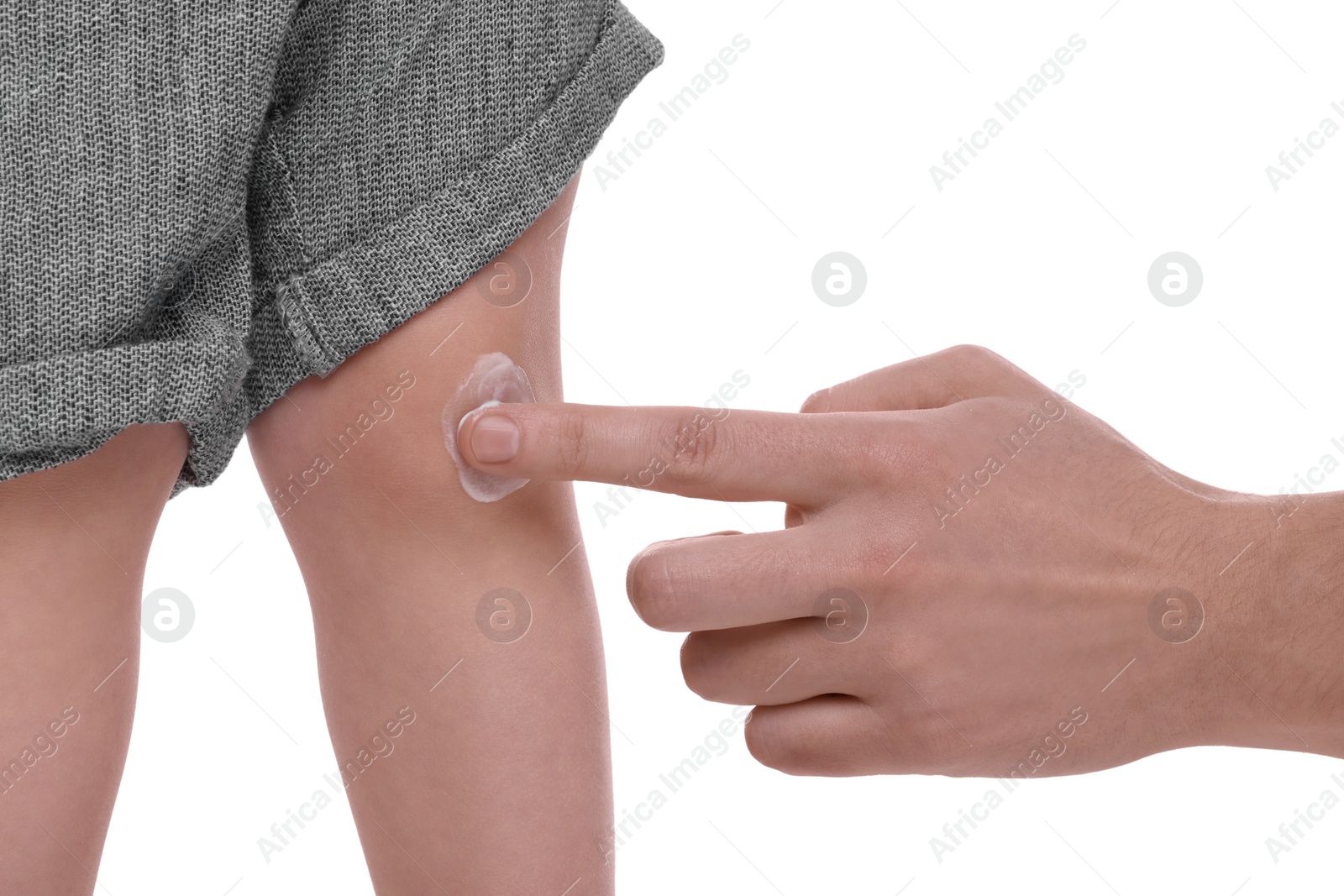 Photo of Father applying ointment onto her son`s knee on white background, closeup