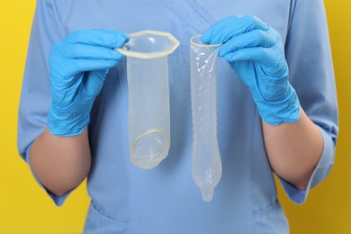 Photo of Doctor with unrolled female and male condoms on yellow background, closeup. Safe sex