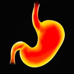 Illustration of  diseased stomach on black background. Gastroenterology