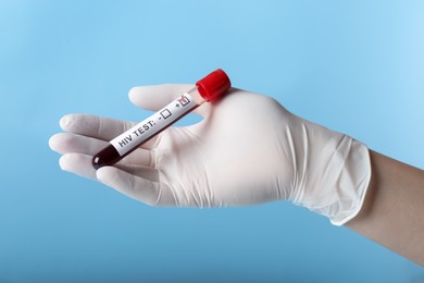 Photo of Scientist holding tube with blood sample and label HIV Test on light blue background, closeup