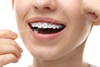 Woman with braces cleaning teeth using dental floss on white background, closeup