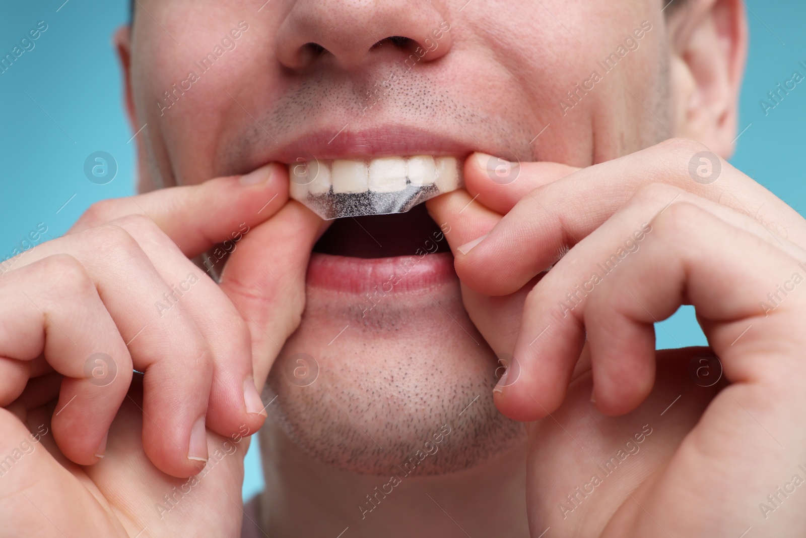 Photo of Young man applying whitening strip on his teeth against light blue background, closeup