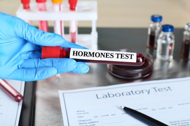 Photo of Doctor holding glass tube with blood sample and label Hormone Test at table, closeup