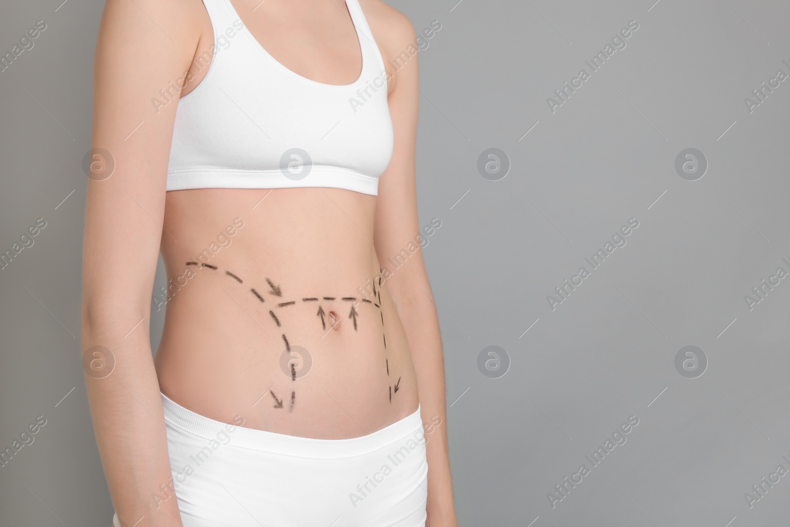 Photo of Young woman with marks on belly for cosmetic surgery operation against color background