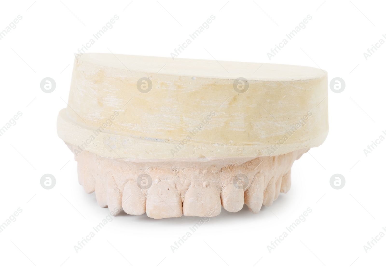 Photo of Dental model with jaw isolated on white. Cast of teeth