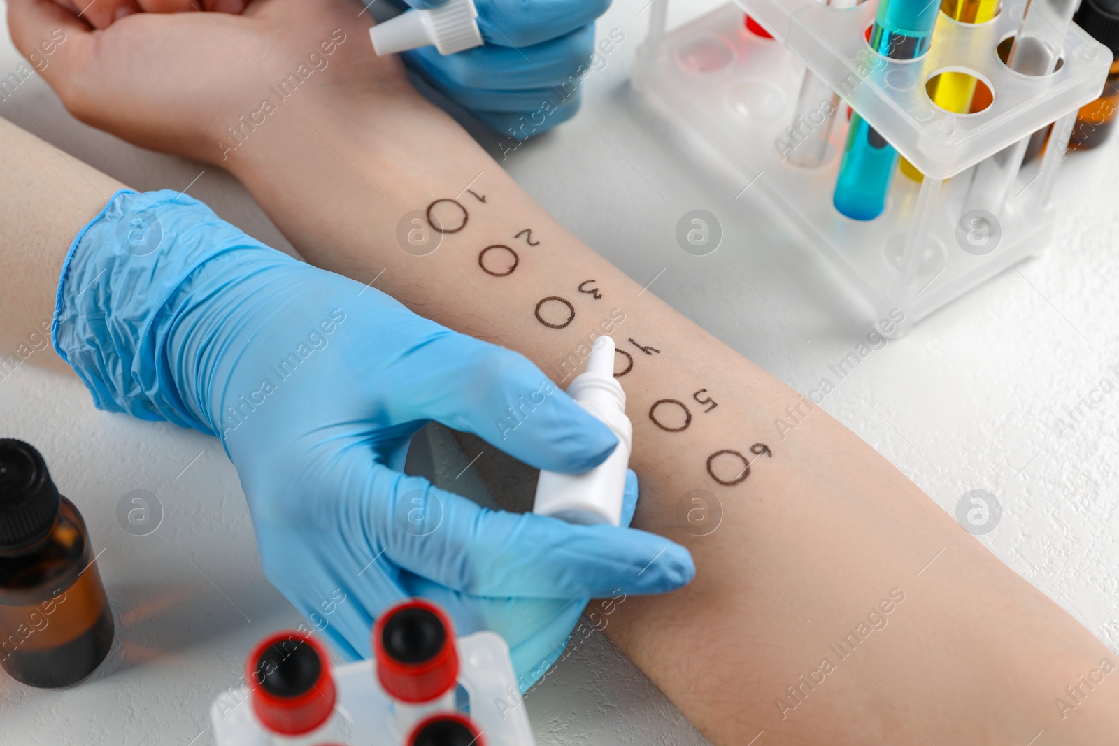 Photo of Doctor doing skin allergy test at light table, closeup