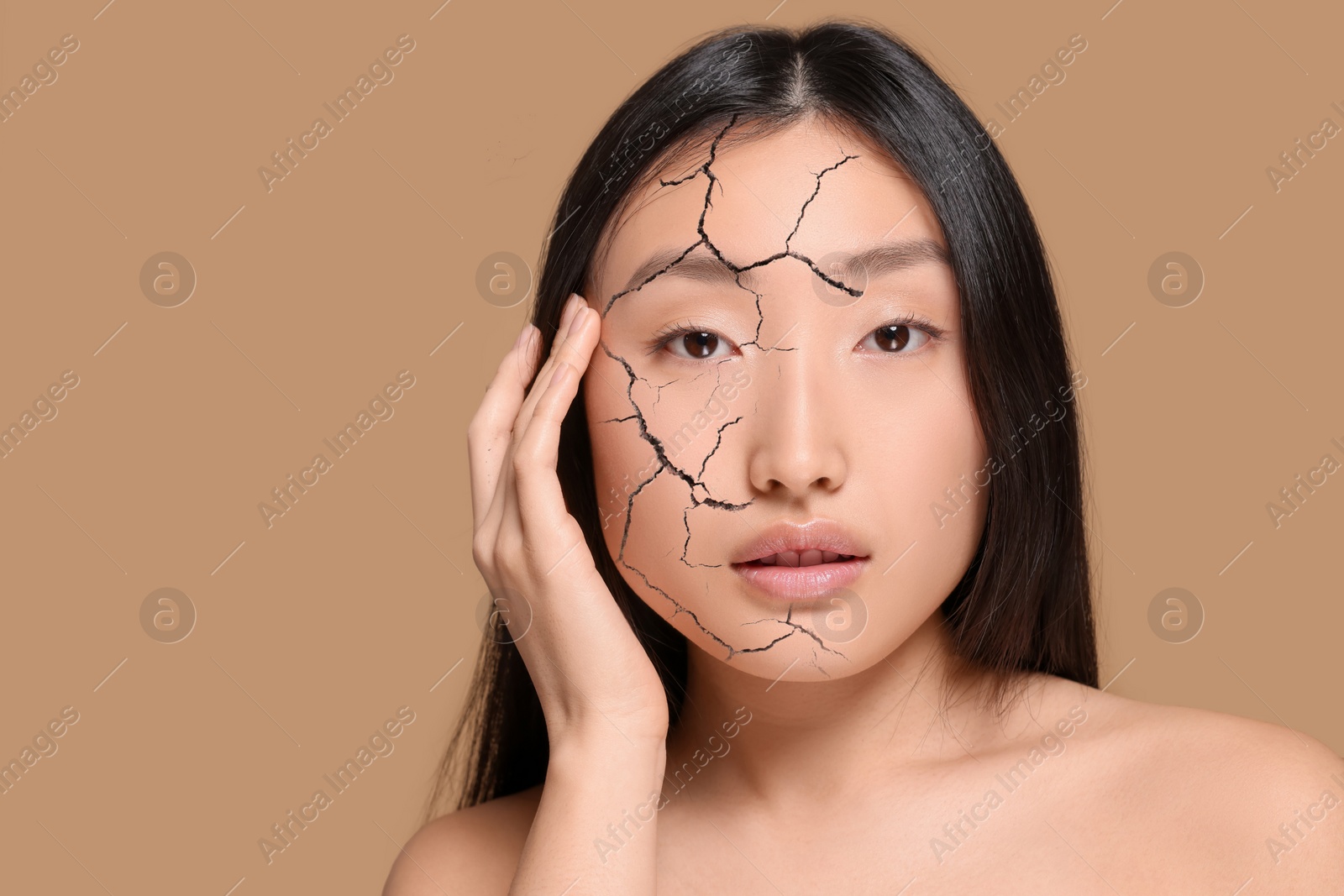 Image of Beautiful woman with dry skin on beige background. Space for text