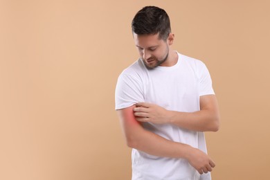 Photo of Allergy symptom. Man scratching his arm on light brown background. Space for text