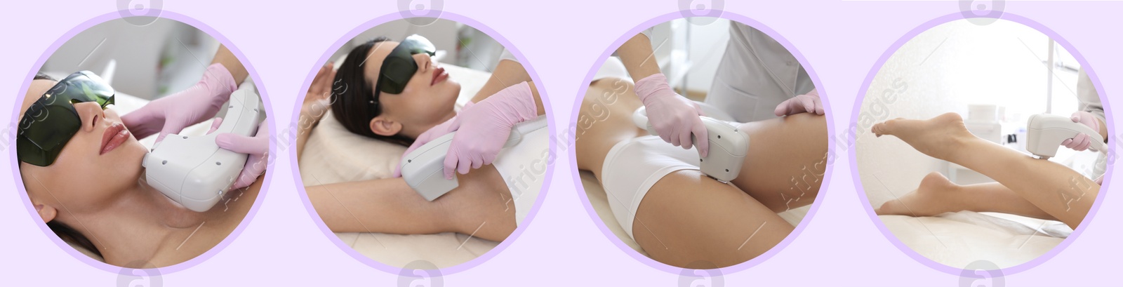 Image of Collage with photos of woman undergoing laser epilation procedure. Banner design