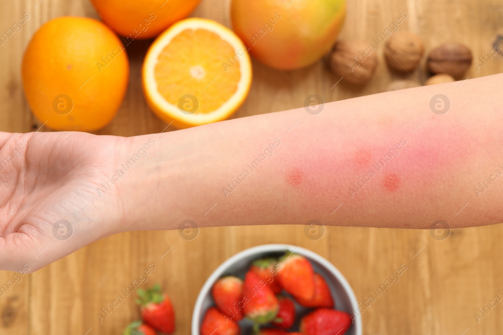 Photo of Food allergy. Woman holding hand over products on table, closeup