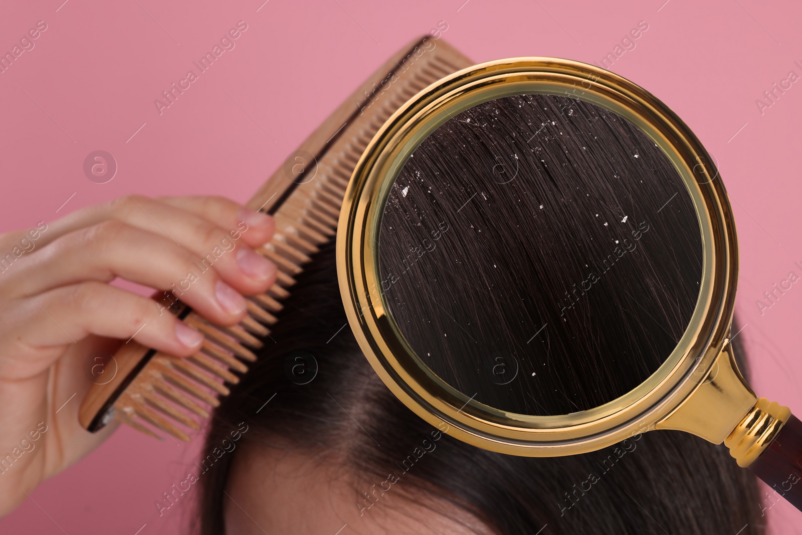 Image of Woman suffering from dandruff on pink background, closeup. View through magnifying glass on hair with flakes