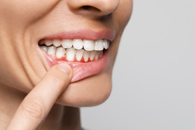 Woman showing inflamed gum on grey background, closeup. Space for text