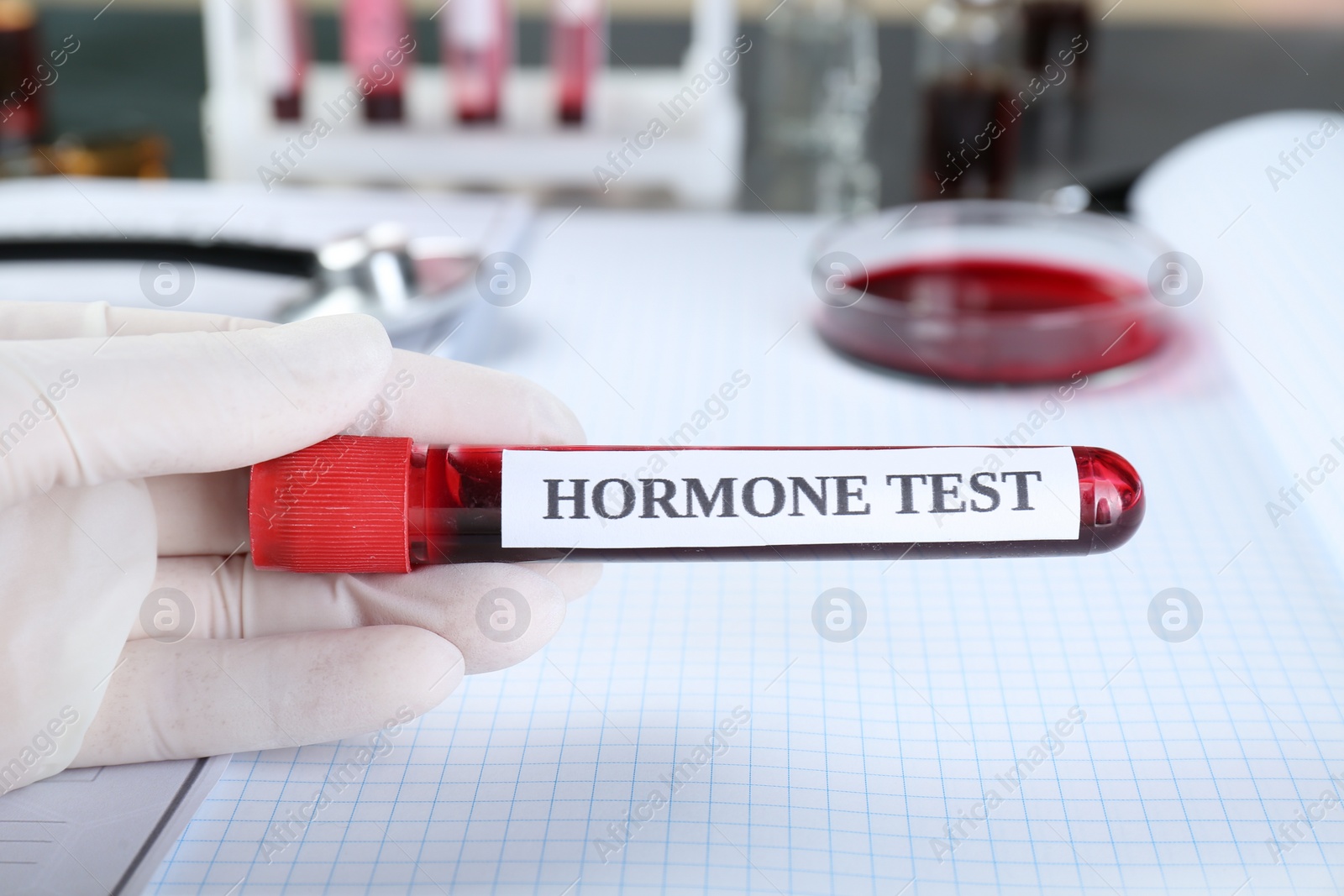 Photo of Doctor holding glass tube with blood sample and label Hormone Test at table, closeup