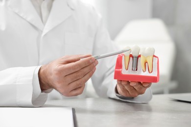Photo of Doctor showing educational model of dental implant in clinic, closeup