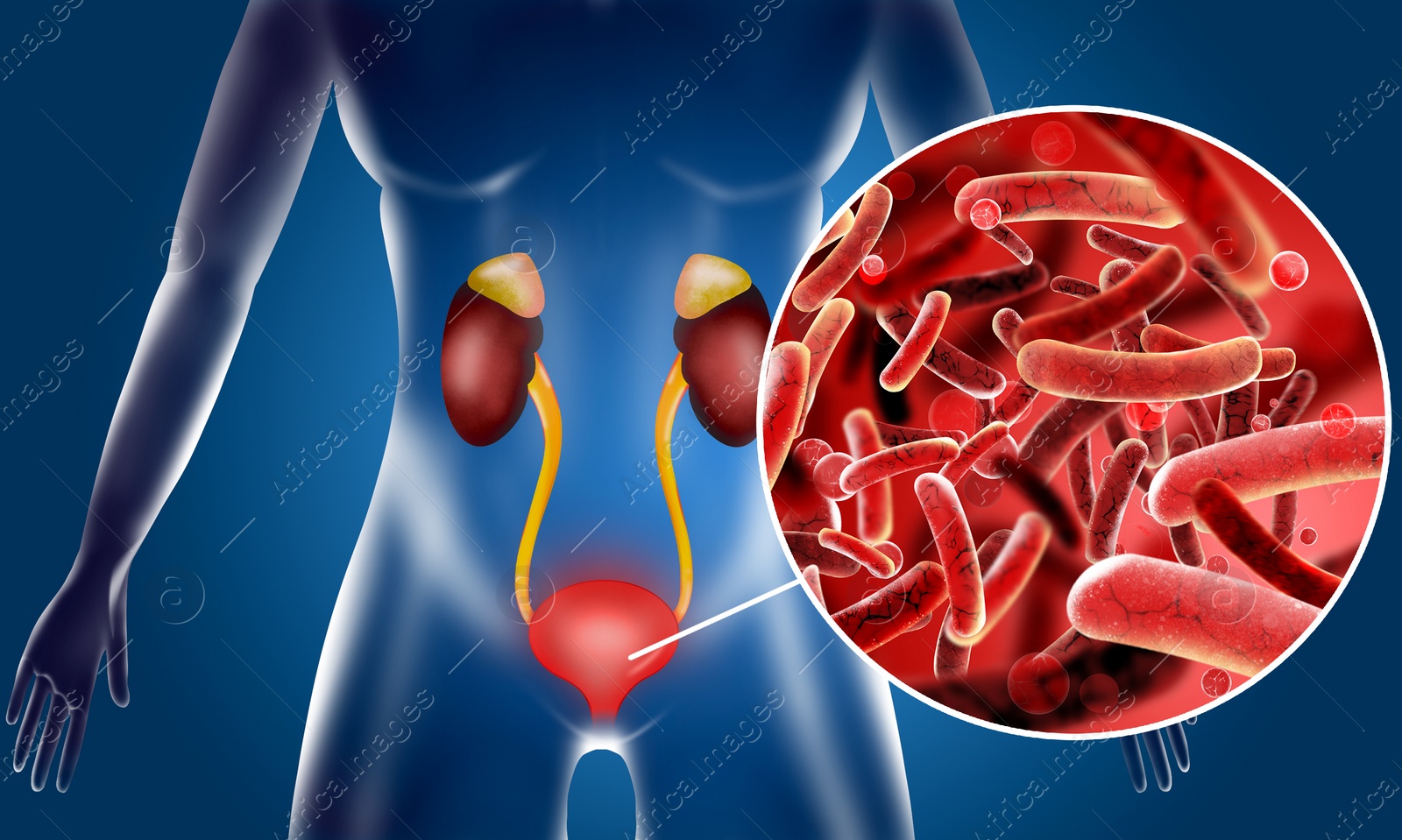 Illustration of  woman suffering from cystitis. Urinary infection