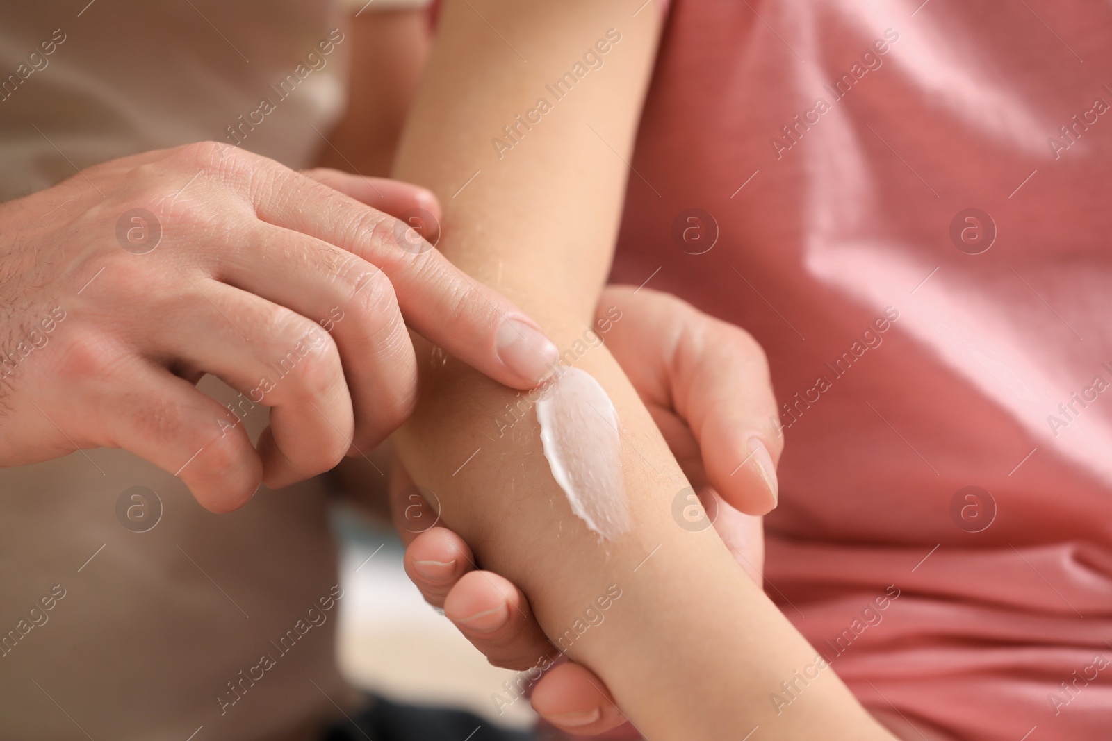 Photo of Father applying ointment onto his daughter's arm, closeup