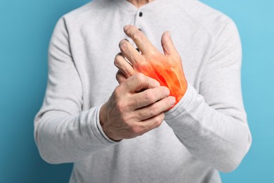 Image of Arthritis symptoms. Man suffering from pain in his hand on light blue background, closeup