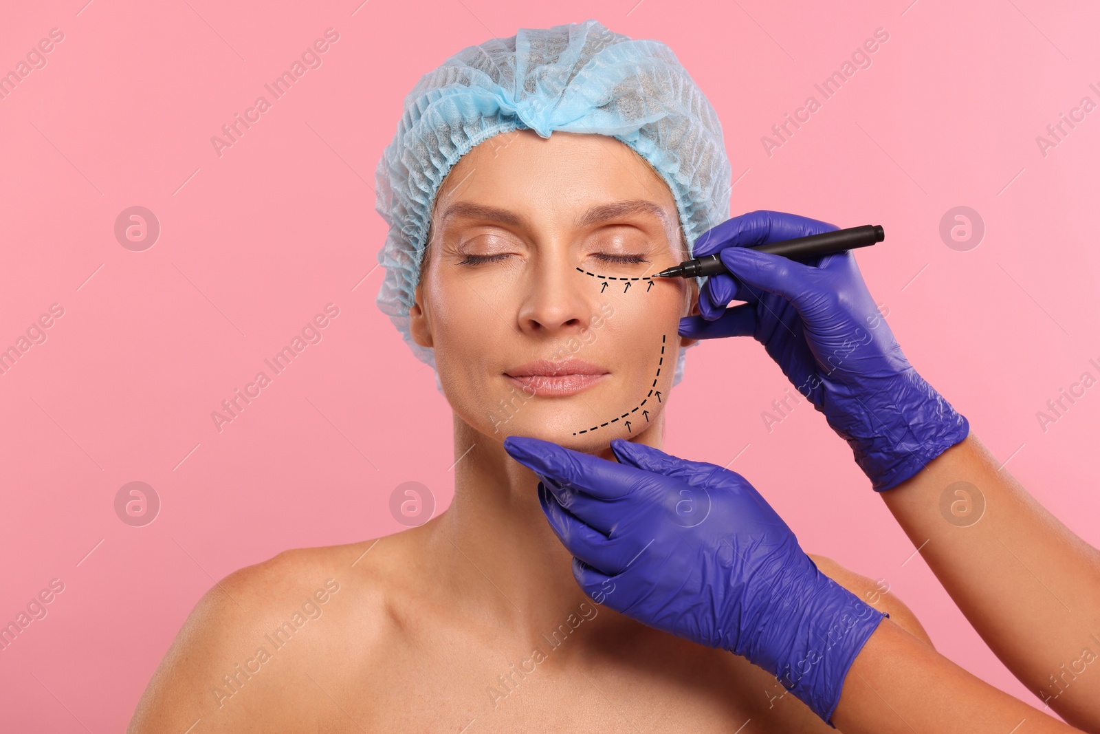 Image of Woman preparing for cosmetic surgery, pink background. Doctor drawing markings on her face, closeup