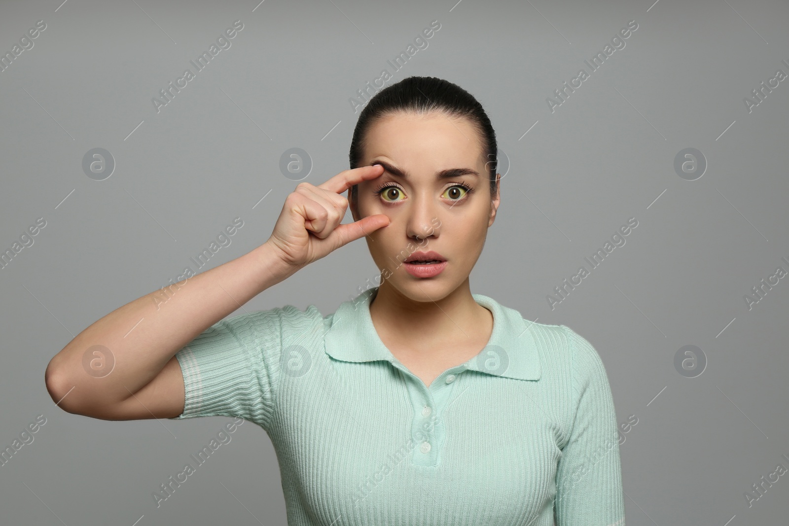 Photo of Woman checking her health condition on grey background. Yellow eyes as symptom of problems with liver