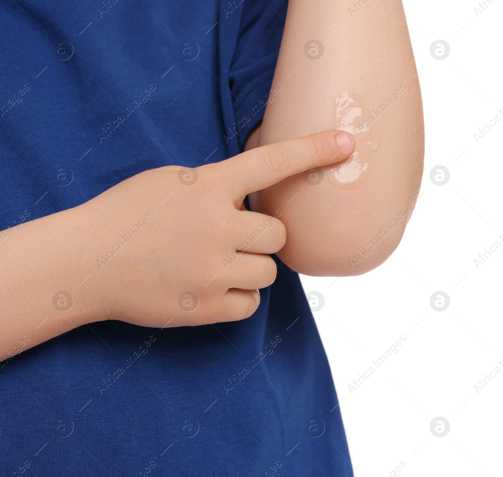 Photo of Child applying ointment onto elbow isolated on white, closeup