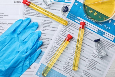 Photo of Flat lay composition with laboratory equipment and urine samples on light background. Urology concept