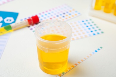 Photo of Container with urine sample for analysis on white table