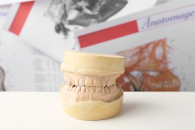 Photo of Dental model with gums on white table. Cast of teeth