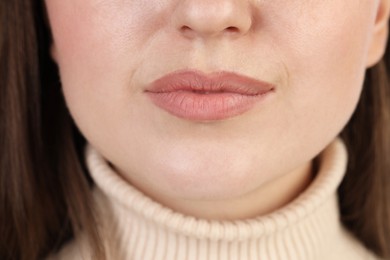 Photo of Closeup view of woman with dry skin