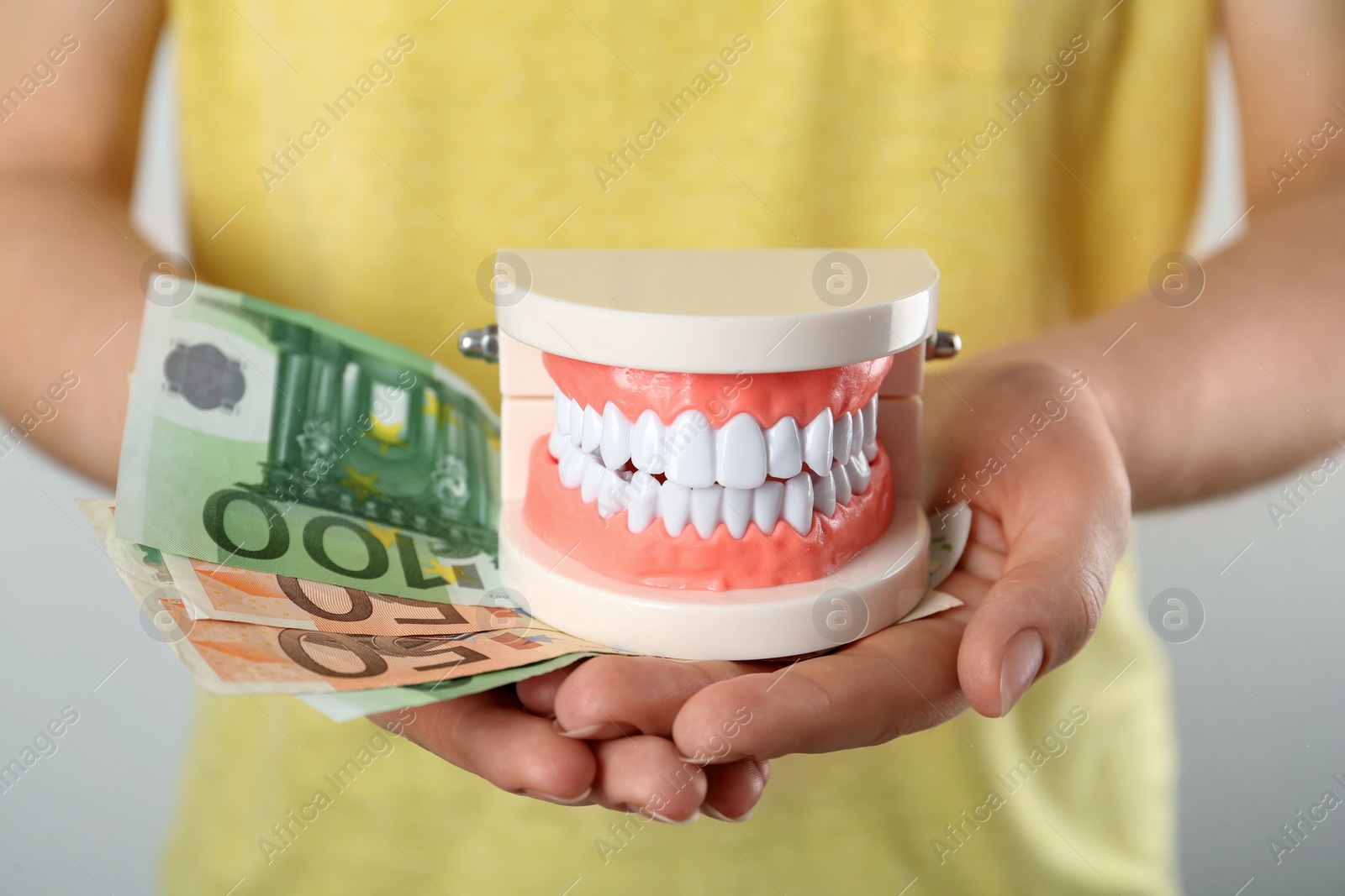 Photo of Woman holding educational dental typodont model and euro banknotes on light background, closeup. Expensive treatment