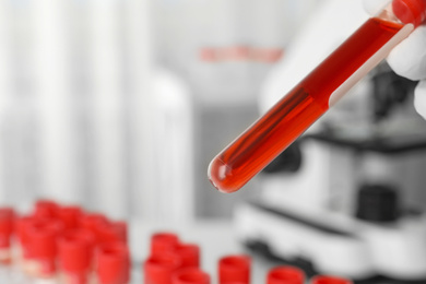 Scientist holding test tube with blood sample in laboratory, closeup. Virus research