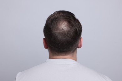 Photo of Baldness concept. Man with bald spot on light grey background, back view