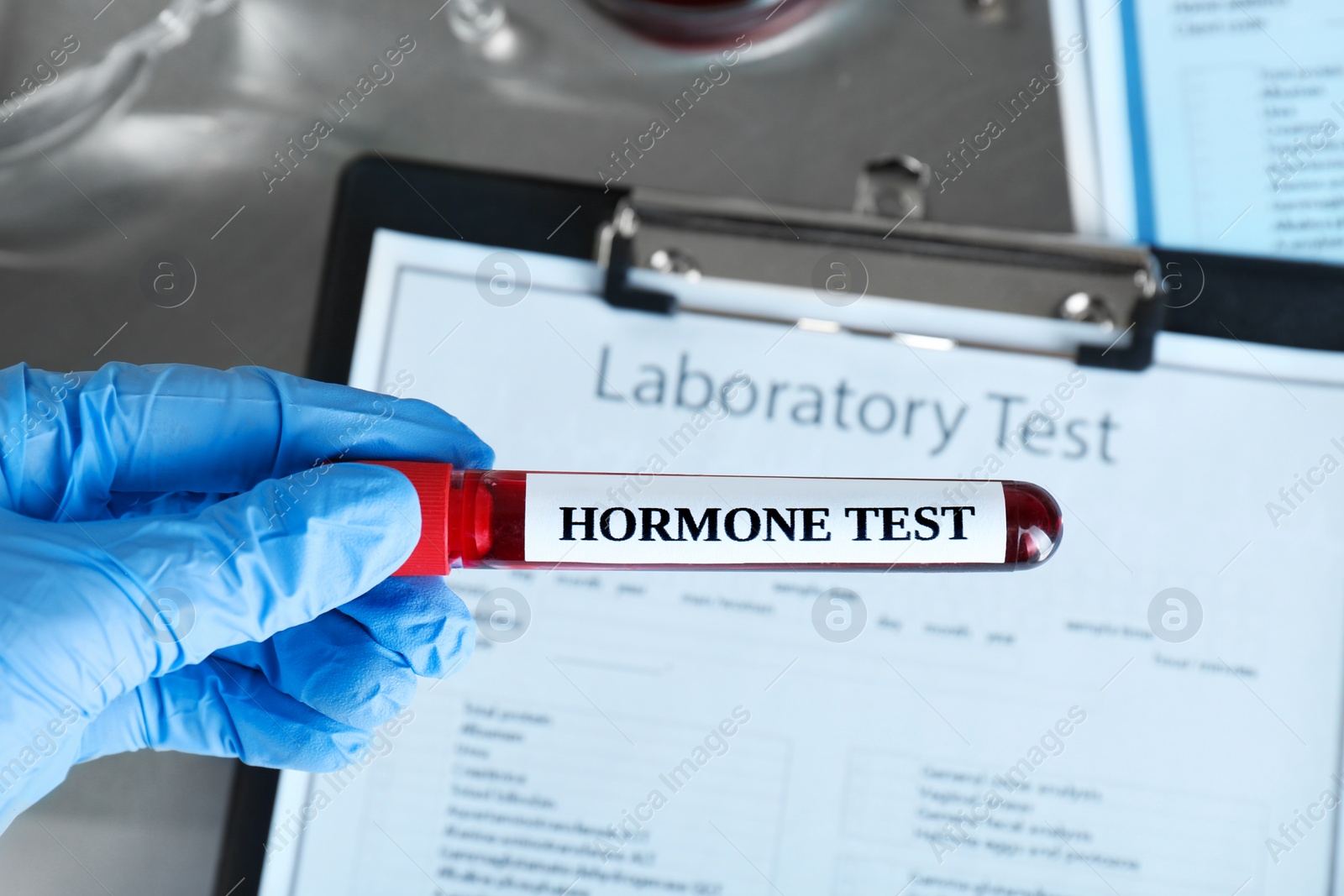 Photo of Doctor holding glass tube with blood sample and label Hormone Test at table, closeup