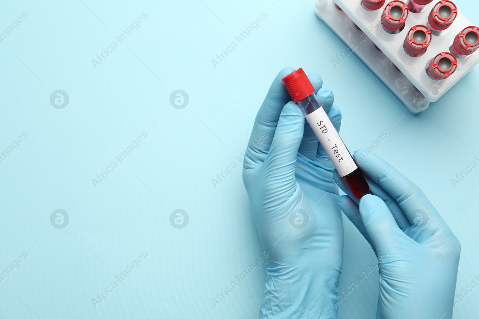 Photo of Scientist holding tube with blood sample and label STD Test on light blue background, top view. Space for text