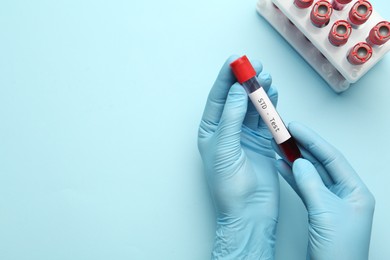 Photo of Scientist holding tube with blood sample and label STD Test on light blue background, top view. Space for text