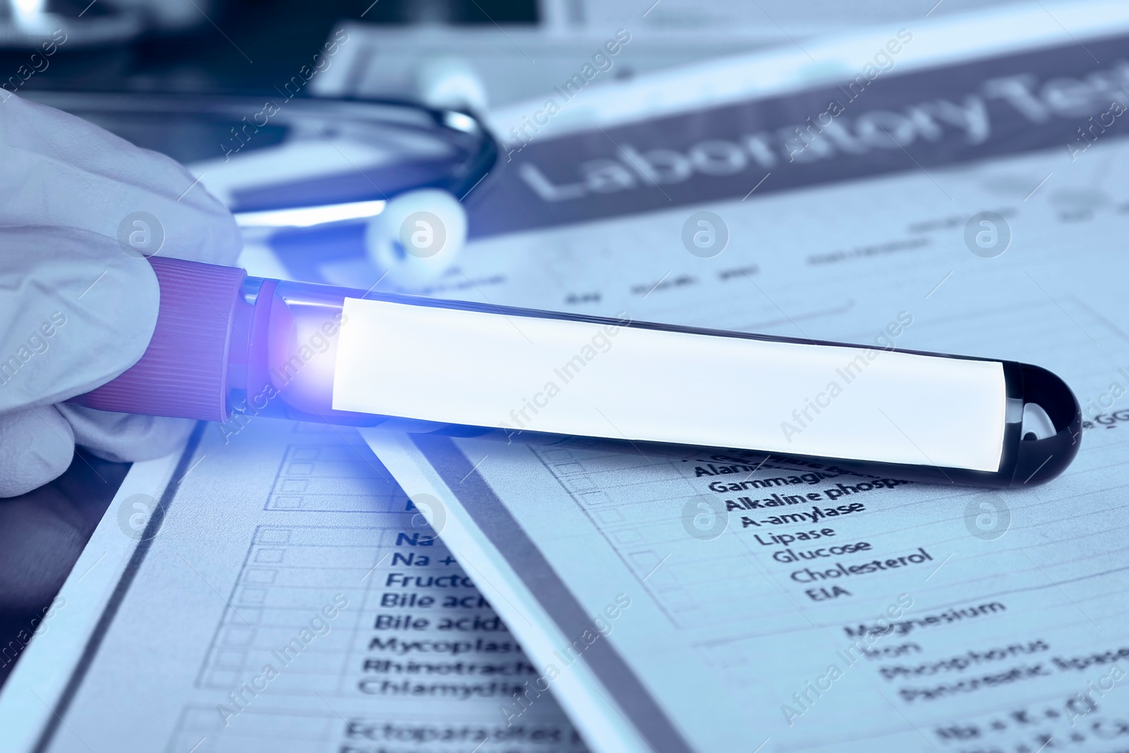 Image of Laboratory worker holding test tube with blood sample over medical form, closeup. Color toned