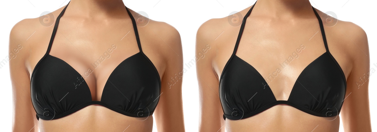 Image of Collage with photos of young woman before and after breast size correction on white background, closeup. Banner design