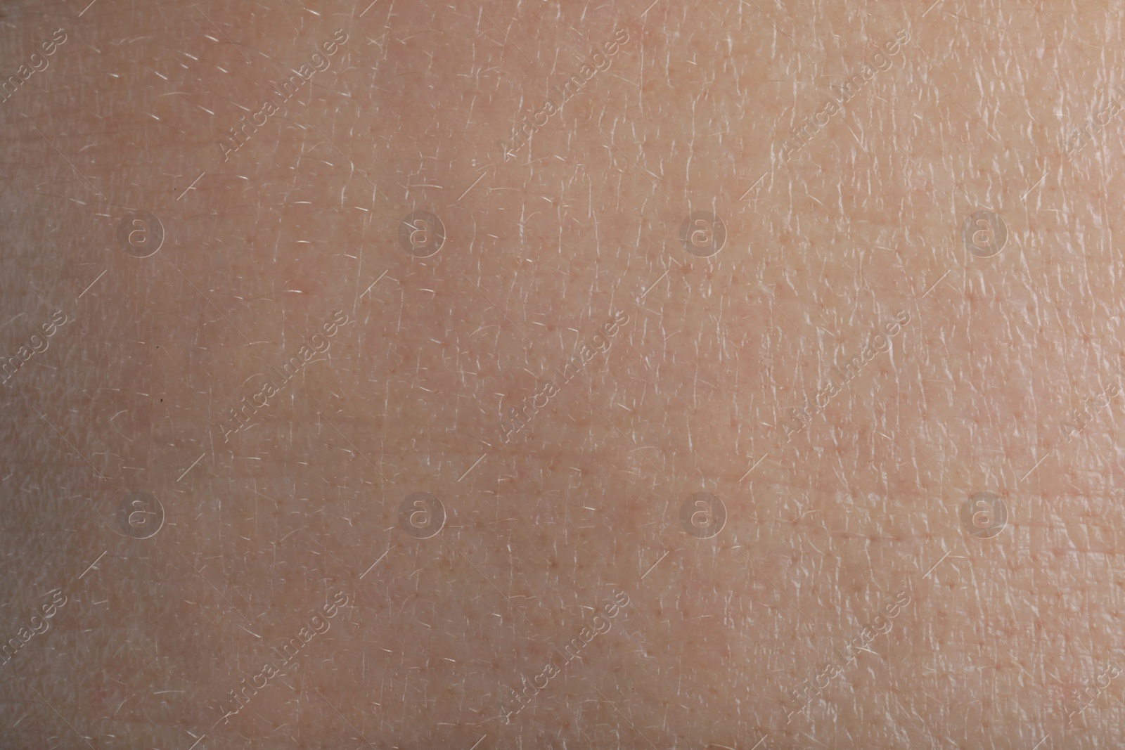 Photo of Closeup view of human skin as background