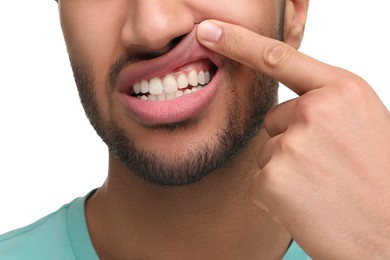 Photo of Man showing his healthy teeth and gums on white background, closeup