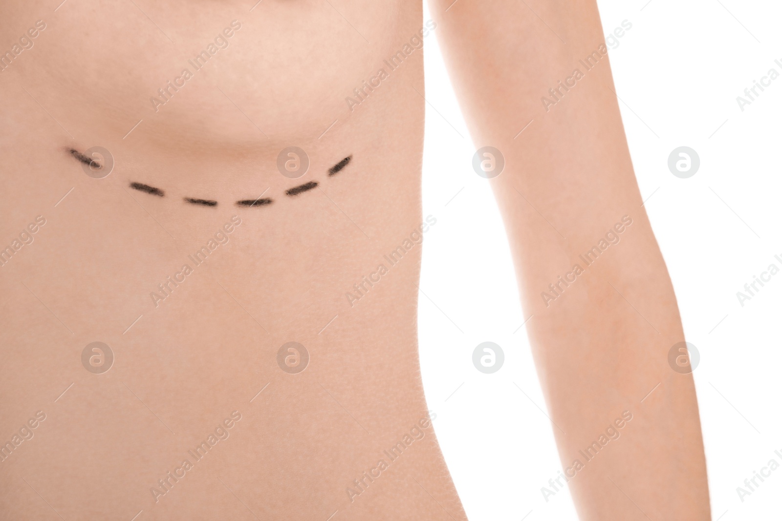 Photo of Young woman with marks on breast for cosmetic surgery operation against white background, closeup