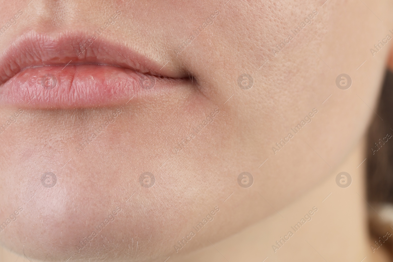 Photo of Closeup view of woman with dry skin