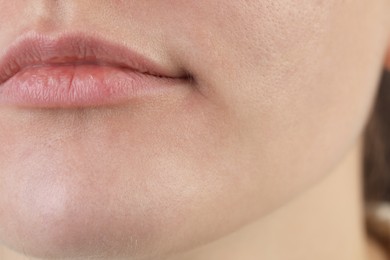 Closeup view of woman with dry skin