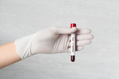 Photo of Scientist holding tube with blood sample and label Hepatitis C on light background, closeup