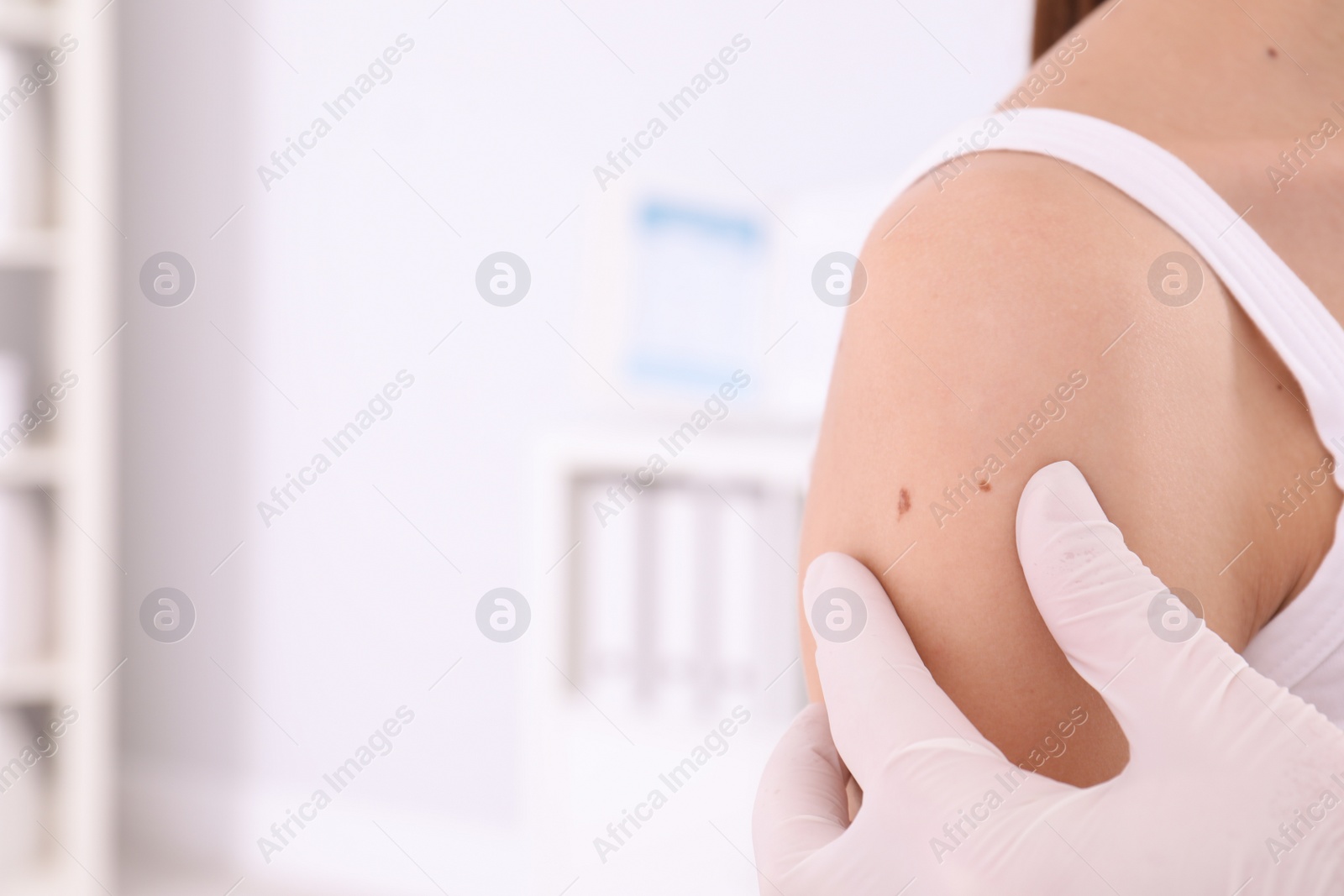 Photo of Dermatologist examining birthmark of patient closeup view, space for text