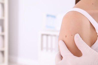 Dermatologist examining birthmark of patient closeup view, space for text