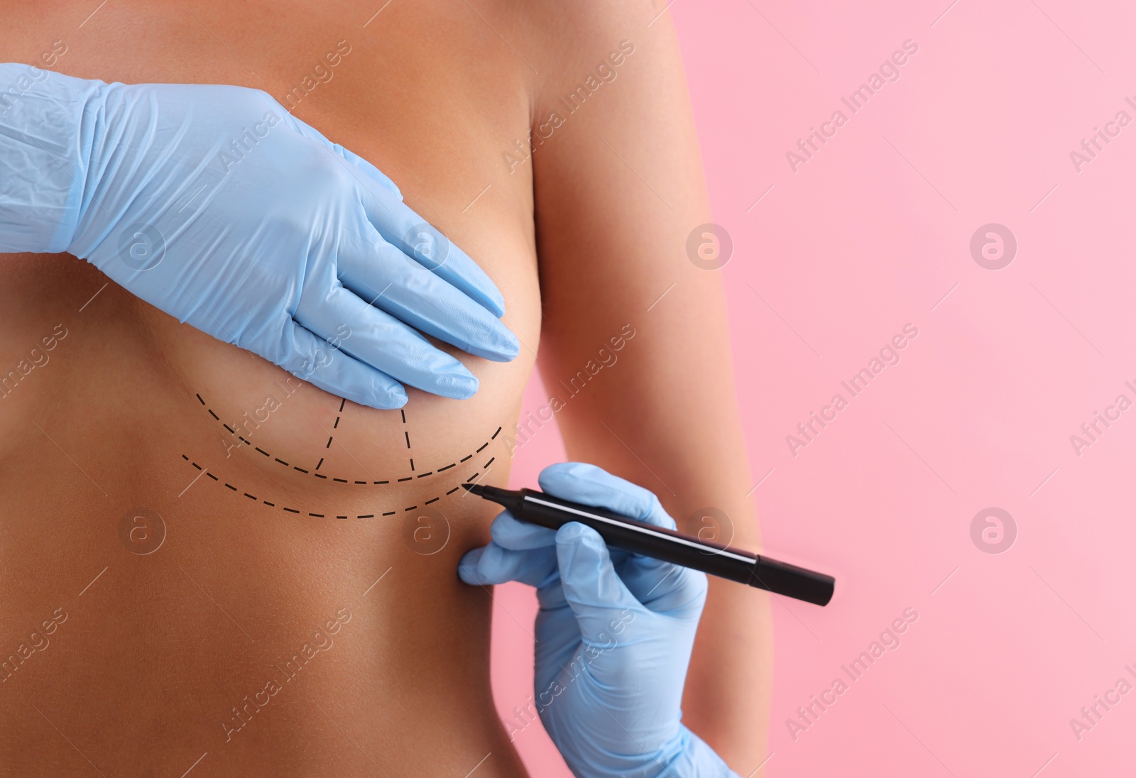 Image of Breast augmentation. Doctor with marker preparing woman for plastic surgery operation against pink background, closeup. Space for text.
